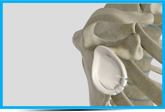 Instability Reconstruction